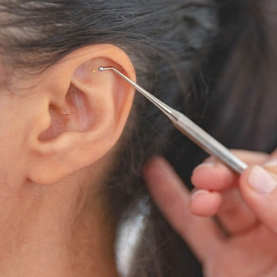 Could Ear Seeding Help Relieve Your Stress?