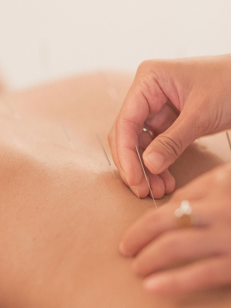 A SPOON FULL OF ACUPUNCTURE