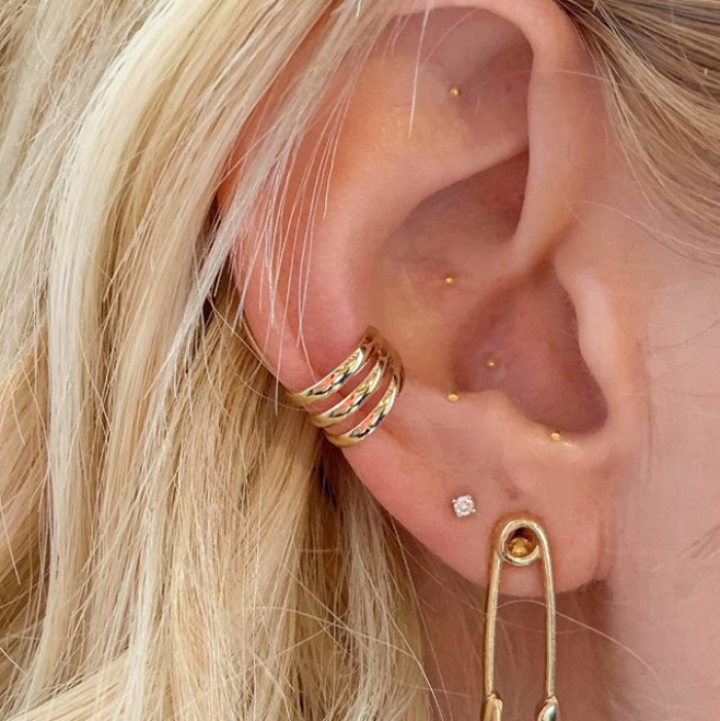 Auricular Acupuncture: What's the Deal With Those Tiny Gold Studs?