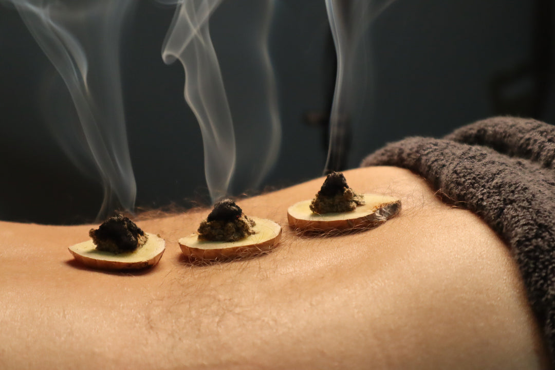 Moxibustion: A Healing Journey