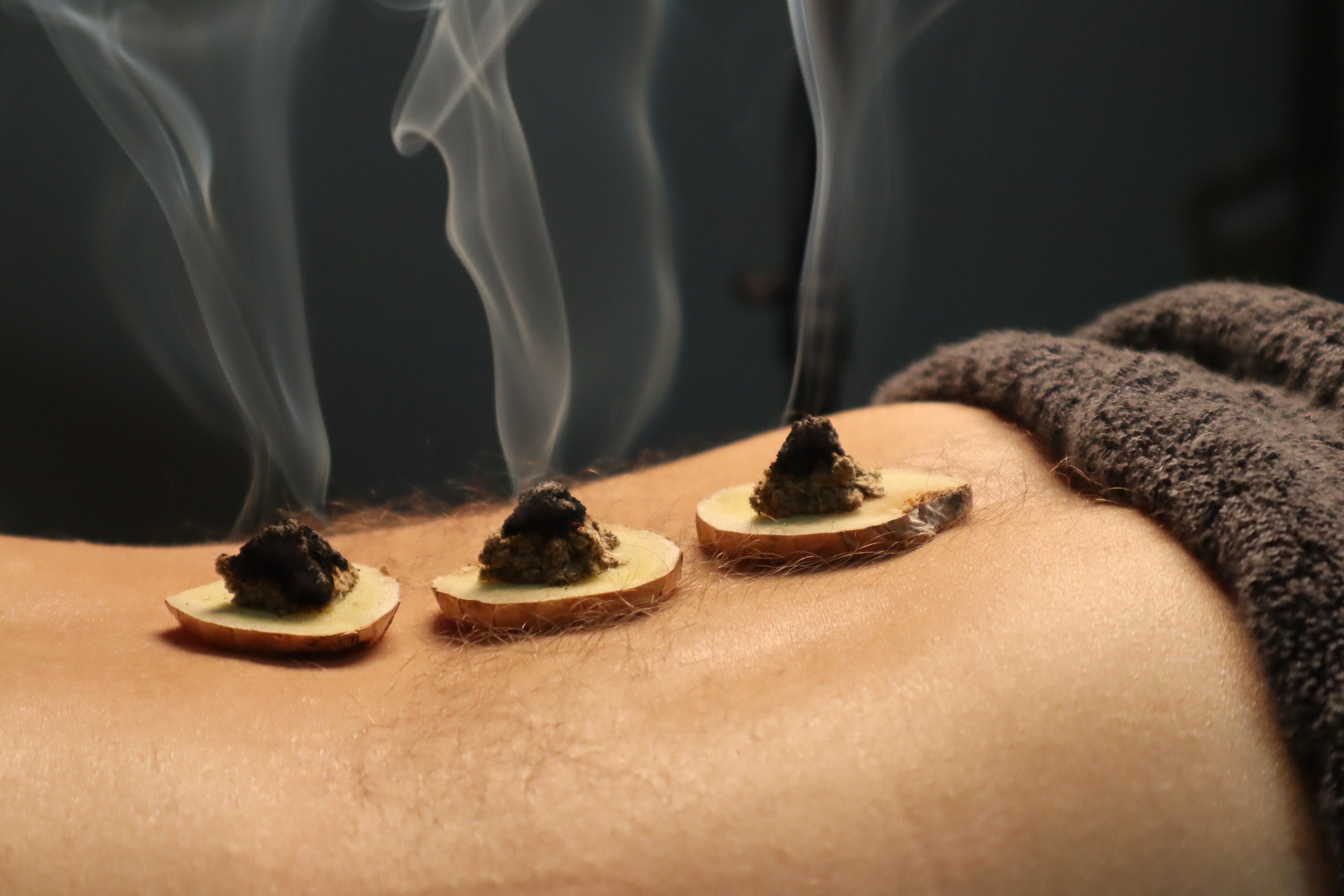 Moxibustion: A Healing Journey